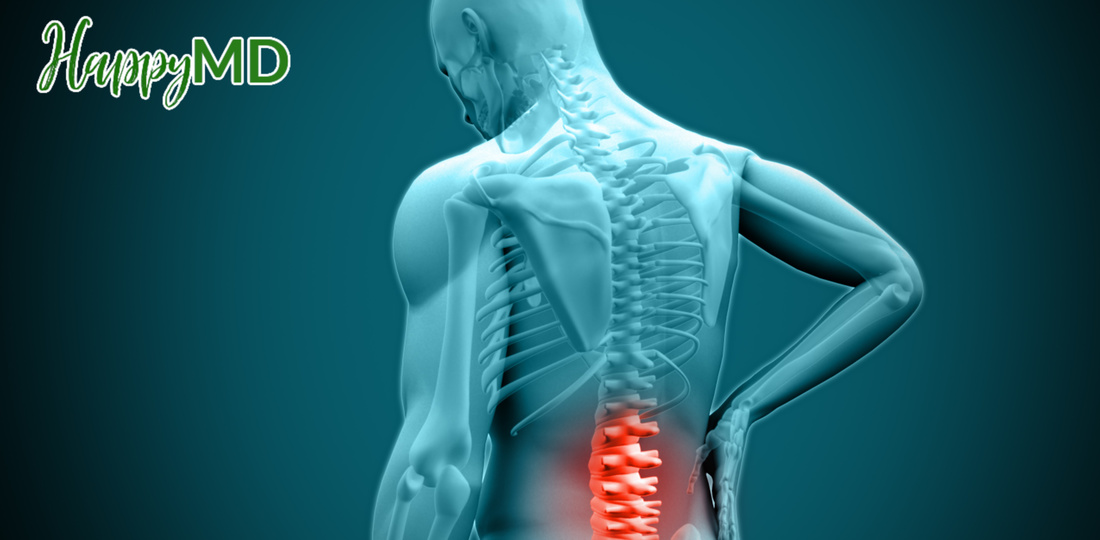 Medical Marijuana and Back Pain Guide 